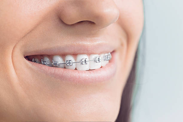 Best Full Mouth Reconstruction  in Rome, IL